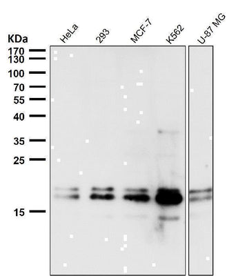 Anti-DUT Rabbit Monoclonal Antibody Boster Bio