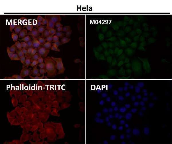 Anti-JNK3 Rabbit Monoclonal Antibody Boster Bio
