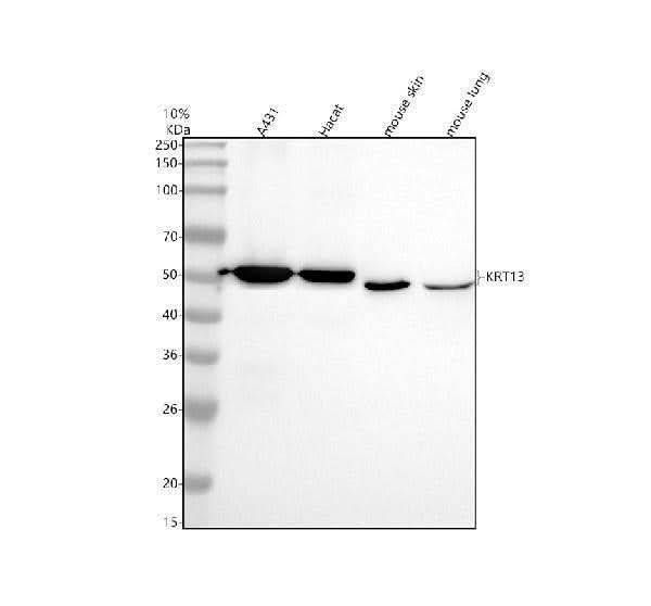 Anti-Cytokeratin 13 Rabbit Monoclonal Antibody Boster Bio