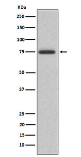 Anti-ABI2 Rabbit Monoclonal Antibody Boster Bio