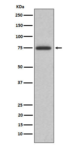 Anti-ABI2 Rabbit Monoclonal Antibody Boster Bio