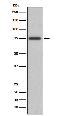 Anti-ABI2 Rabbit Monoclonal Antibody Boster Bio