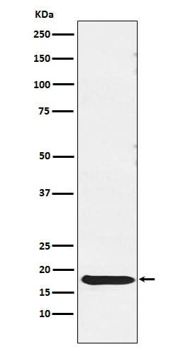 Anti-TSH beta Rabbit Monoclonal Antibody Boster Bio