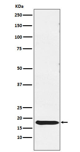 Anti-TSH beta Rabbit Monoclonal Antibody Boster Bio