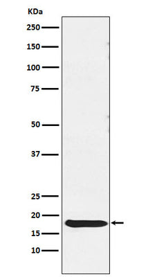 Anti-TSH beta Rabbit Monoclonal Antibody Boster Bio