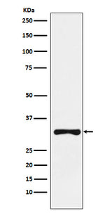 Anti-RYBP Rabbit Monoclonal Antibody Boster Bio