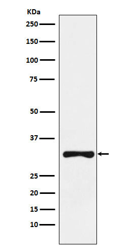 Anti-RYBP Rabbit Monoclonal Antibody Boster Bio
