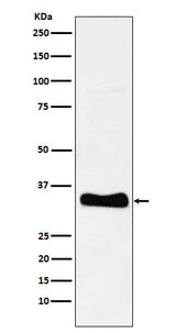 Anti-Monoacylglycerol Lipase Rabbit Monoclonal Antibody Boster Bio