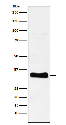 Anti-Monoacylglycerol Lipase Rabbit Monoclonal Antibody Boster Bio