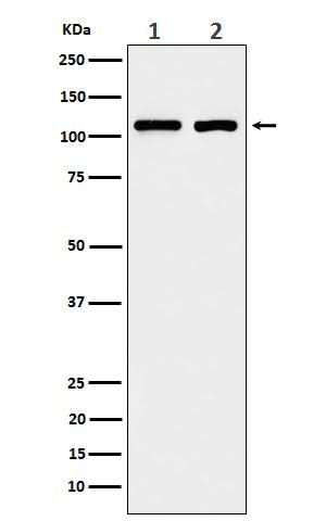 Anti-eIF3B Rabbit Monoclonal Antibody Boster Bio