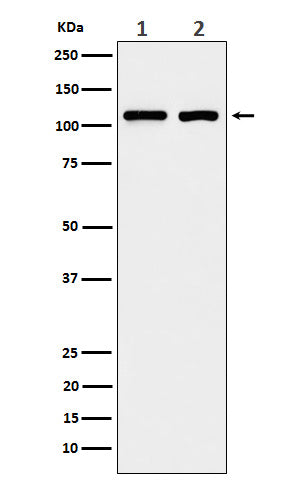 Anti-eIF3B Rabbit Monoclonal Antibody Boster Bio
