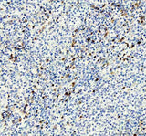 Anti-Thymidylate Synthase TYMS Monoclonal Antibody Boster Bio