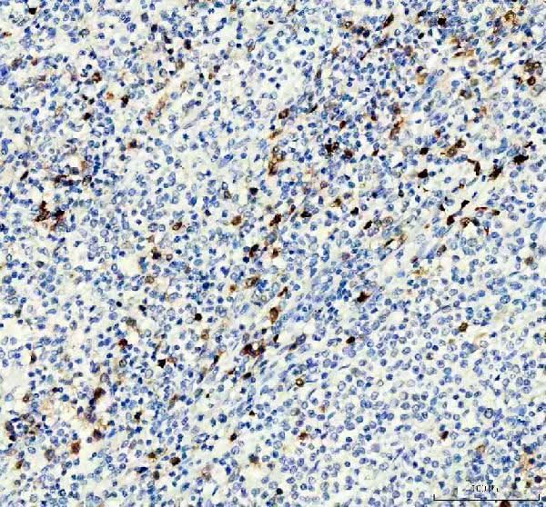 Anti-Thymidylate Synthase TYMS Monoclonal Antibody Boster Bio