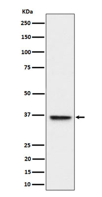 Anti-ULBP1 Rabbit Monoclonal Antibody Boster Bio