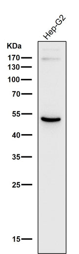 Anti-ADFP PLIN2 Rabbit Monoclonal Antibody Boster Bio