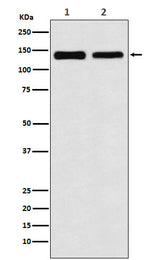 Anti-UBE4B Rabbit Monoclonal Antibody Boster Bio
