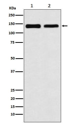 Anti-UBE4B Rabbit Monoclonal Antibody Boster Bio