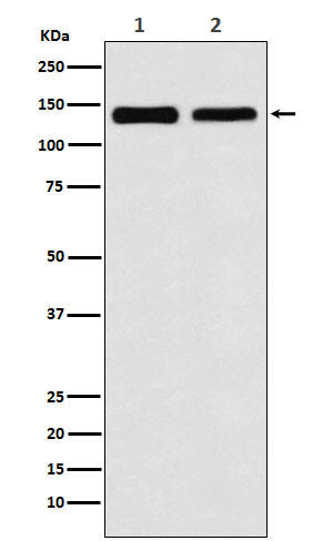 Anti-UBE4B Rabbit Monoclonal Antibody Boster Bio