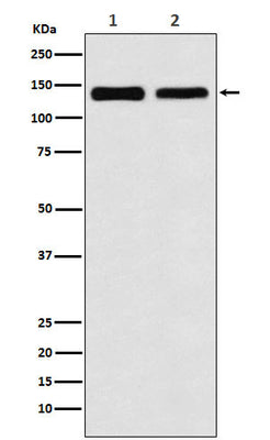 Anti-UBE4B Rabbit Monoclonal Antibody Boster Bio