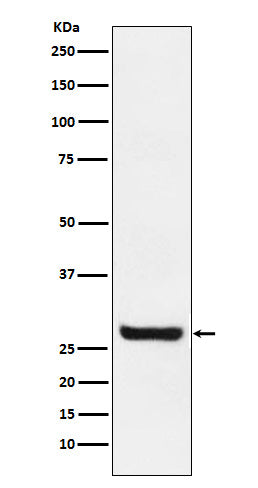 Anti-Sprouty 4 Rabbit Monoclonal Antibody Boster Bio