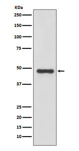 Anti-Urokinase Rabbit Monoclonal Antibody Boster Bio