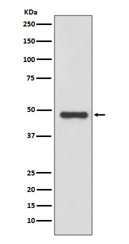 Anti-Urokinase Rabbit Monoclonal Antibody Boster Bio