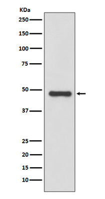 Anti-Urokinase Rabbit Monoclonal Antibody Boster Bio