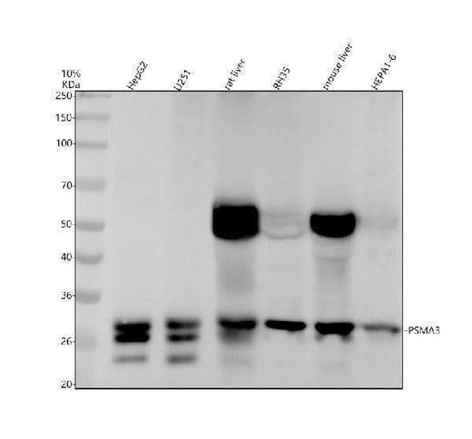 Anti-PSMA3 Rabbit Monoclonal Antibody Boster Bio