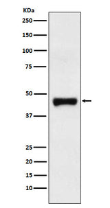 Anti-LRG1 Rabbit Monoclonal Antibody Boster Bio