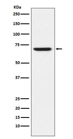 Anti-GABA A Receptor alpha 5 Rabbit Monoclonal Antibody Boster Bio