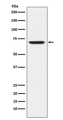 Anti-GABA A Receptor alpha 5 Rabbit Monoclonal Antibody Boster Bio