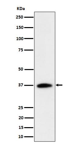 Anti-RASSF2 Rabbit Monoclonal Antibody Boster Bio