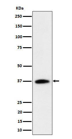 Anti-RASSF2 Rabbit Monoclonal Antibody Boster Bio
