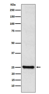 Anti-TPPP Rabbit Monoclonal Antibody Boster Bio