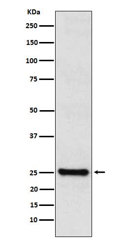 Anti-TPPP Rabbit Monoclonal Antibody Boster Bio