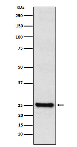 Anti-TPPP Rabbit Monoclonal Antibody Boster Bio