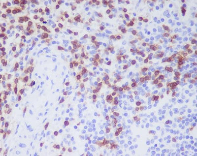 Anti-CD3D Rabbit Monoclonal Antibody Boster Bio