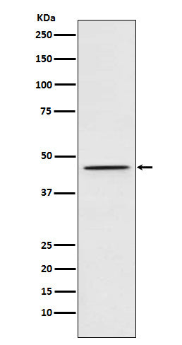 Anti-DEK Rabbit Monoclonal Antibody Boster Bio