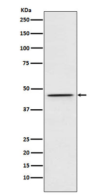 Anti-DEK Rabbit Monoclonal Antibody Boster Bio