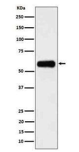 Anti-CD116 Rabbit Monoclonal Antibody Boster Bio