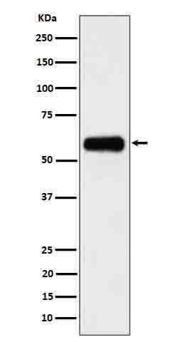 Anti-CD116 Rabbit Monoclonal Antibody Boster Bio
