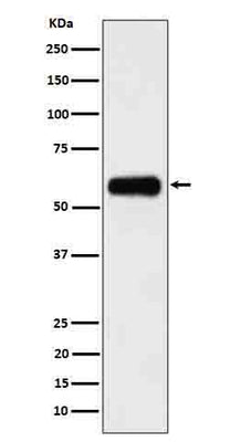 Anti-CD116 Rabbit Monoclonal Antibody Boster Bio