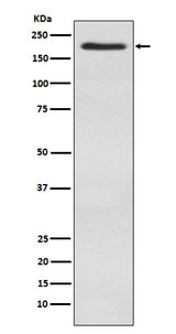 Anti-WSTF Rabbit Monoclonal Antibody Boster Bio