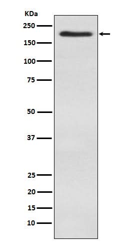 Anti-WSTF Rabbit Monoclonal Antibody Boster Bio