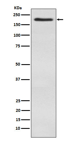 Anti-WSTF Rabbit Monoclonal Antibody Boster Bio