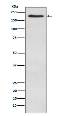 Anti-WSTF Rabbit Monoclonal Antibody Boster Bio