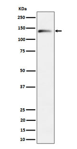 Anti-delta 2 Catenin Rabbit Monoclonal Antibody Boster Bio