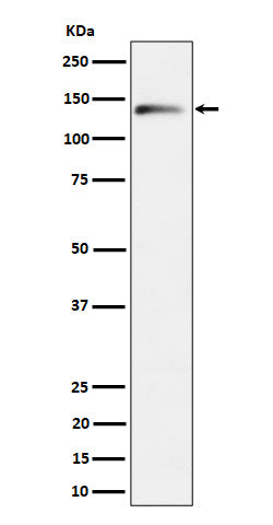 Anti-delta 2 Catenin Rabbit Monoclonal Antibody Boster Bio
