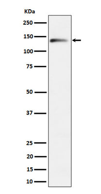 Anti-delta 2 Catenin Rabbit Monoclonal Antibody Boster Bio