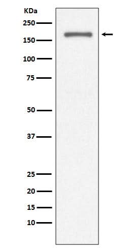 Anti-CD11a ITGAL Rabbit Monoclonal Antibody Boster Bio